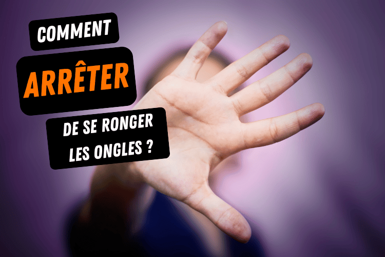 Onychophagie - Comment arrêter de se ronger les ongles définitivement